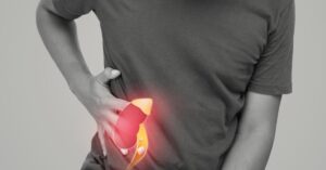 kidney doctor in indore, kidney stone treatment in indore