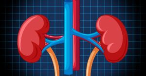 Non-surgical kidney stones treatment options explained by a kidney doctor in Indore including medicines, hydration, and laser treatment